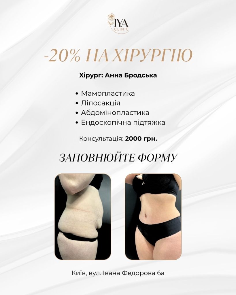-20% на пластичні операції в хірургині  Анни Бродської